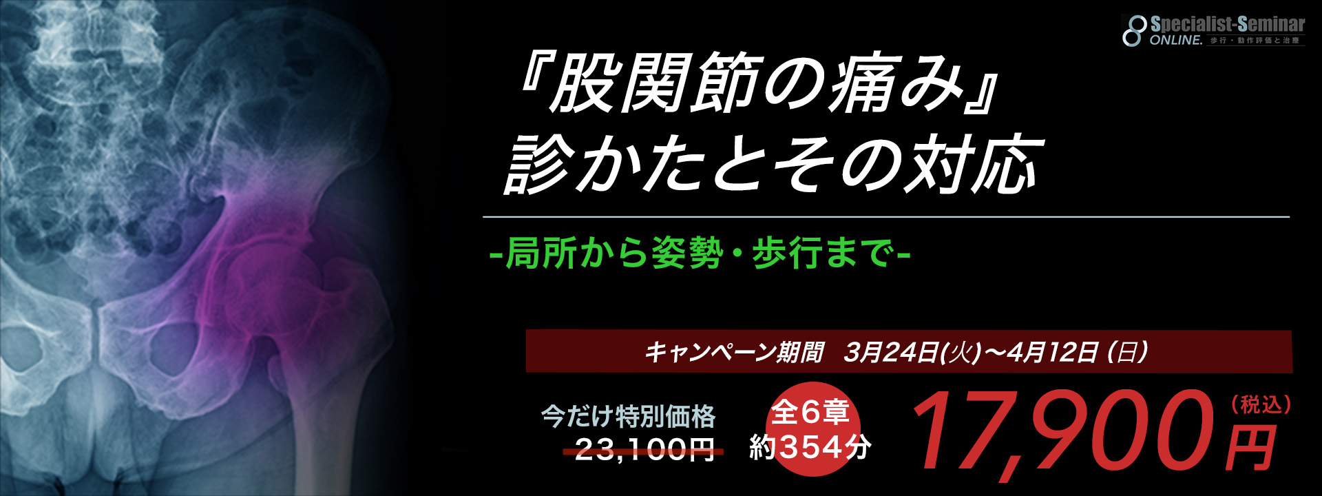 『股関節の痛み』診かたとその対応